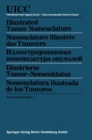 Image for Illustrated Tumor Nomenclature / Nomenclature illustree des Tumeurs / NZN N N N N N N N N N / Illustrierte Tumor-Nomenklatur / Nomenclatura ilustrada de los Tumores