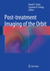 Image for Post-treatment Imaging of the Orbit