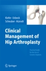 Image for Clinical Management of Hip Arthroplasty: Practical Guide for the Use of Ceramic Implants