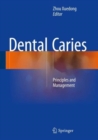 Image for Dental Caries