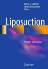 Image for Liposuction  : principles and practice