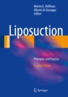 Image for Liposuction: Principles and Practice