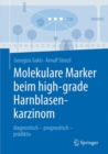 Image for Molekulare Marker beim high-grade Harnblasenkarzinom