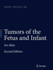 Image for Tumors of the Fetus and Infant : An Atlas