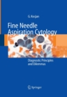 Image for Fine Needle Aspiration Cytology