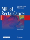 Image for MRI of Rectal Cancer : Clinical Atlas