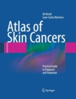 Image for Atlas of Skin Cancers : Practical Guide to Diagnosis and Treatment