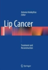 Image for Lip Cancer