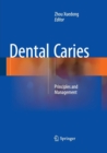 Image for Dental Caries : Principles and Management