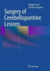 Image for Surgery of Cerebellopontine Lesions