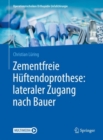 Image for Zementfreie Huftendoprothese: lateraler Zugang nach Bauer