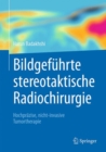 Image for Bildgefuhrte stereotaktische Radiochirurgie