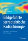 Image for Bildgefuhrte stereotaktische Radiochirurgie: Hochprazise, nicht-invasive Tumortherapie