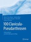 Image for 100 Clavicula-Pseudarthrosen : Fehleranalysen und Behandlungsvorschlage