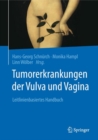 Image for Tumorerkrankungen der Vulva und Vagina