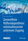 Image for Zementfreie Huftendoprothese: minimalinvasiver anteriorer Zugang