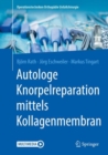 Image for Autologe Knorpelreparation mittels Kollagenmembran