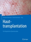 Image for Hauttransplantation: Ein Fotografischer Operationsatlas