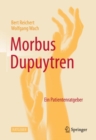 Image for Morbus Dupuytren