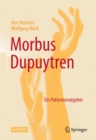 Image for Morbus Dupuytren: Ein Patientenratgeber
