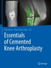 Image for Essentials of Cemented Knee Arthroplasty