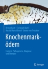 Image for Knochenmarkodem: Formen, Pathogenese, Diagnose Und Therapie