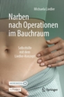 Image for Narben nach Operationen im Bauchraum : Selbsthilfe mit dem Liedler-Konzept