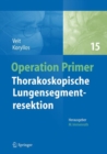 Image for Thorakoskopische Lungensegmentresektion
