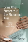Image for Scars After Surgeries in the Abdominal Area