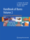 Image for Handbook of burns.: (Reconstruction and rehabilitation)