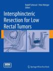 Image for Intersphincteric Resection for Low Rectal Tumors