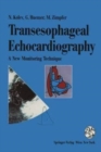 Image for Transesophageal Echocardiography : A New Monitoring Technique