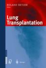 Image for Lung transplantation