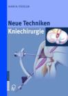 Image for Neue Techniken - Kniechirurgie
