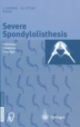 Image for Severe Spondylolisthesis : Pathology-diagnosis-therapy