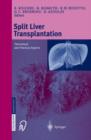 Image for Split liver transplantation