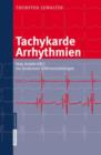 Image for Tachykarde Arrhythmien : Vom Anfalls-Ekg Zur Modernen Differenzialtherapie