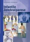 Image for Infantile Zerebralparese: Diagnostik, Konservative Und Operative Therapie