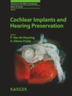 Image for Cochlear Implants and Hearing Preservation