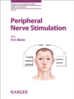 Image for Peripheral nerve stimulation