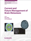 Image for Current and Future Management of Brain Metastasis