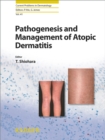 Image for Pathogenesis and Management of Atopic Dermatitis