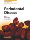 Image for Periodontal disease