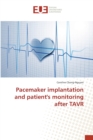 Image for Pacemaker implantation and patient&#39;s monitoring after TAVR