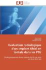 Image for Evaluation Radiologique D Un Implant Tibial En Tantale Dans Les Ptg