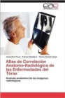 Image for Atlas de Correlacion Anatomo-Radiologica de las Enfermedades del Torax