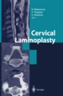 Image for Cervical Laminoplasty