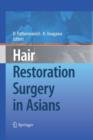 Image for Hair Restoration Surgery in Asians