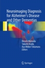 Image for Neuroimaging Diagnosis for Alzheimer&#39;s Disease and Other Dementias