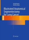 Image for Illustrated Anatomical Segmentectomy for Lung Cancer